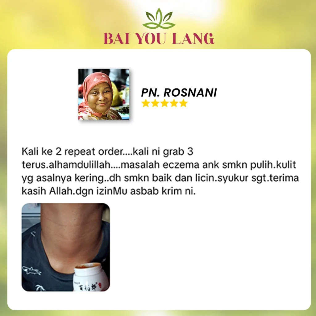 2A.webp