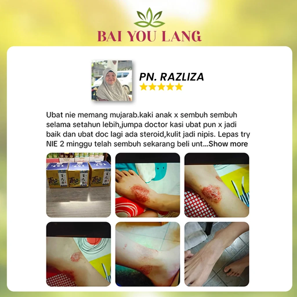 3A.webp